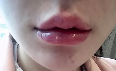 [쁘띠] 얼툥초 - 입술