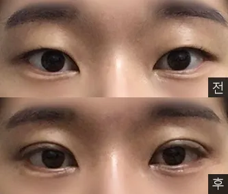 [눈] 구름이맑음 - 눈