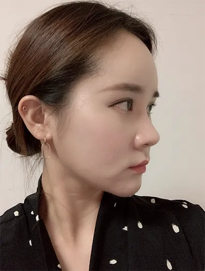 [쁘띠] 키야호1115 - 리프팅