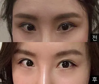 [눈] 라이라이라이 - 눈