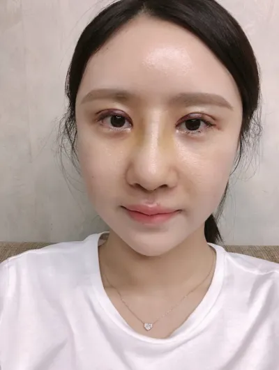 [코] 제뉘블리 - 눈, 코