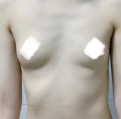 [가슴] 이로코이 - 가슴