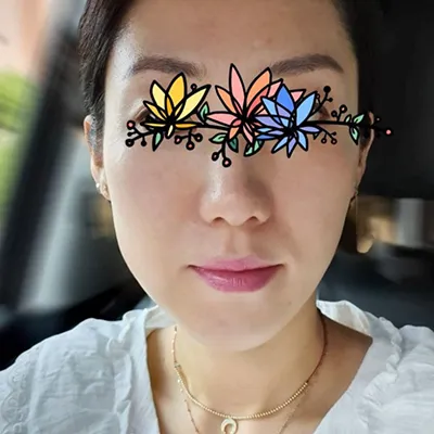 [코] 총총총순이 - 코조각주사, 콧볼보톡스