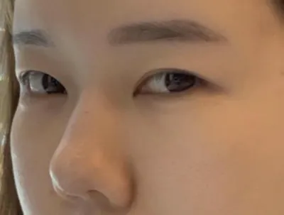 [눈] 고니얌 - 눈, 코