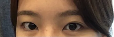 [눈] 도리도리a - 눈