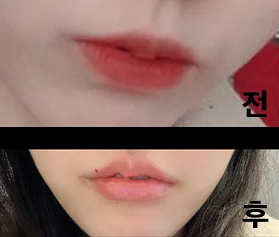 [쁘띠] 웅와앙 - 입술필러