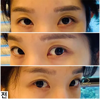 [눈] 따딴블리 - 눈