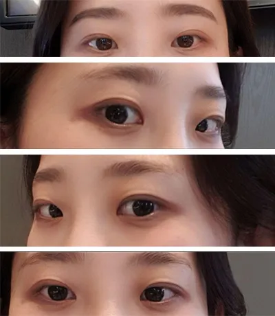 [눈] 수수수꽃다 - 눈