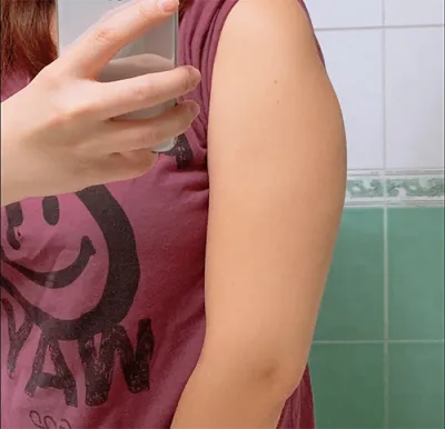 [지방흡입] 블루베리용 - 지방흡입