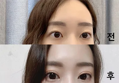 [눈] ski03078 - 눈