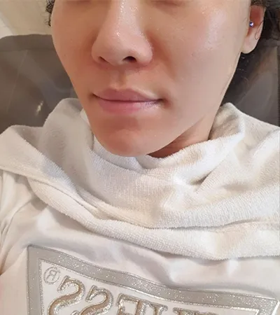 [피부] 봉베리 - 에어슈링크