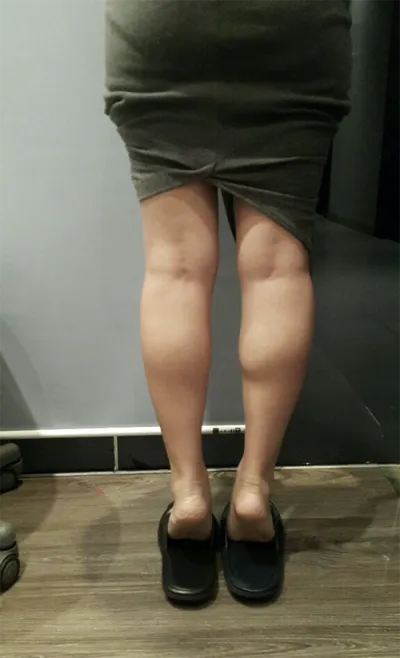 [쁘띠] 향기엄마 - 종아리