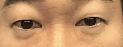 [눈] 부다다 - 눈