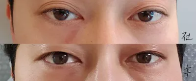 [눈] 탄탄도블리 - 눈