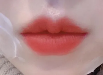 [쁘띠] hunnie8894 - 입술필러