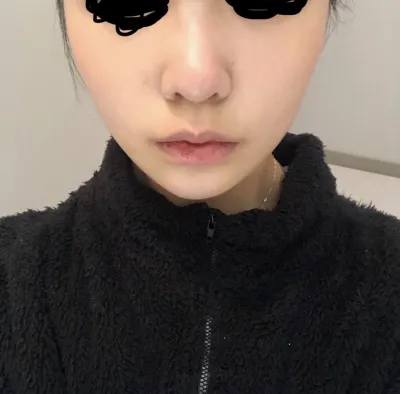 [코] mm9 - 콧볼축소