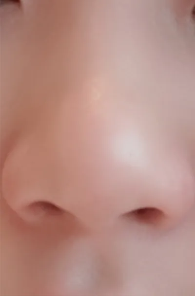 [쁘띠] 7시11분 - 코조각주사