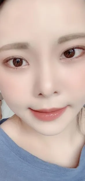 [눈] songi1938 - 뒤트임,밑트임