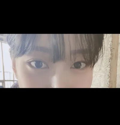 [눈] yong0423 - 뒤트임,밑트임