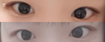 [눈] 신은서입니다 - 눈