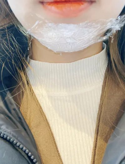 [쁘띠] 복츙ㅇㅏ뽑호 - 턱끝필러, 보톡스