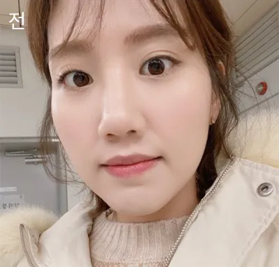 [눈] 감성로코 - 눈