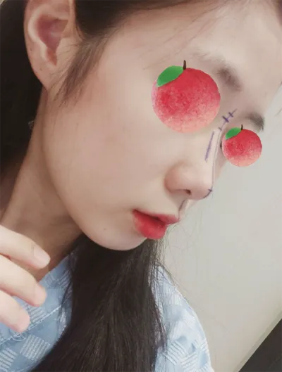 [코] 두두스무디 - 코