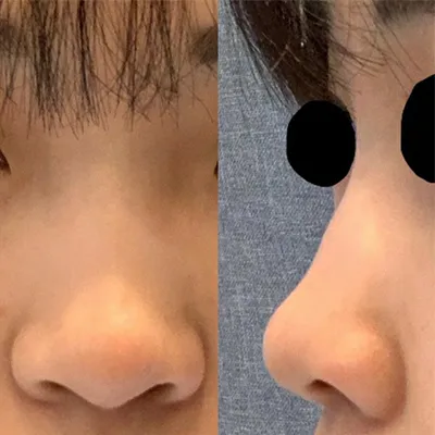 [코] 뀽뀽공 - 코