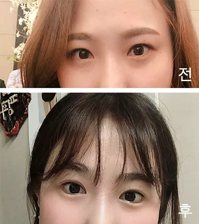 [눈] 뀨진아 - 뒤트임,밑트임