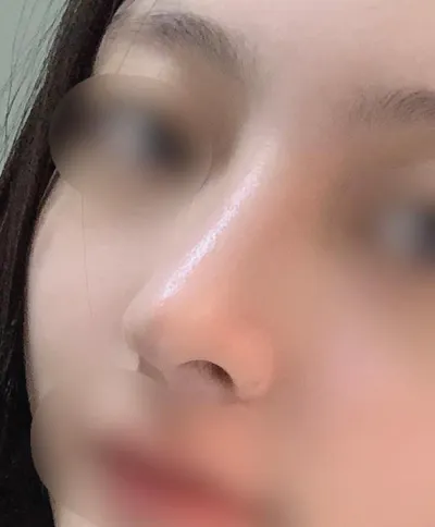 [코] 쥬비0111 - 코