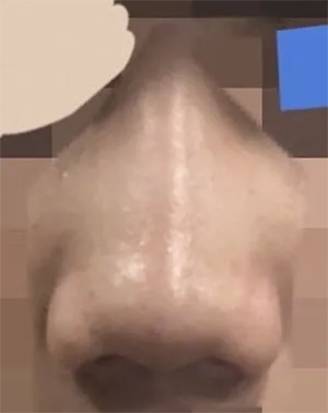 [코] 가나수수수 - 코