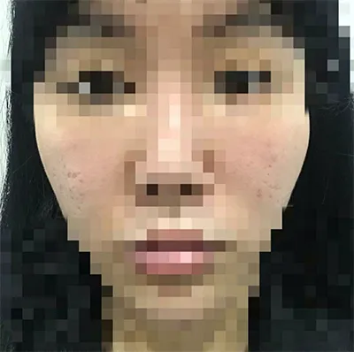 [쁘띠] yuyya - 윤곽주사