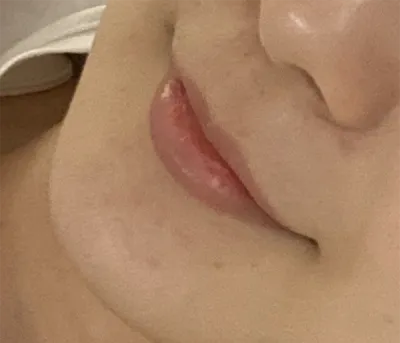 [쁘띠] 구름구름2 - 입술