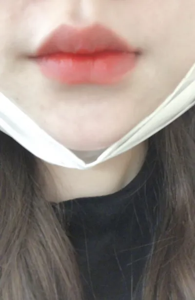 [쁘띠] 리리걸 - 입술필러