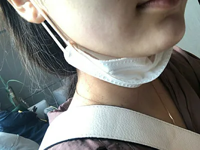 [피부] 웅삼 - 슈링크