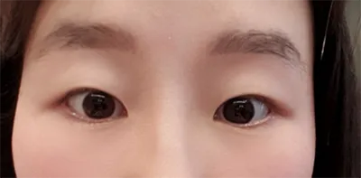 [눈] 메갈로돈 - 눈