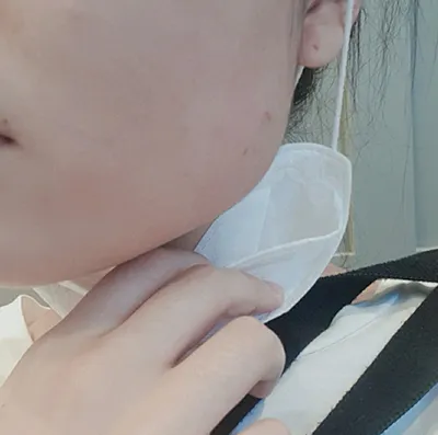 [쁘띠] seoul - 턱보톡스