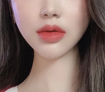 [쁘띠] 세요링 - 콧볼 보톡스