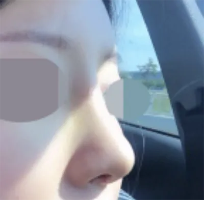 [코] ggggghhhhhhhh - 코