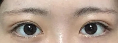 [눈] 권동하 - 눈