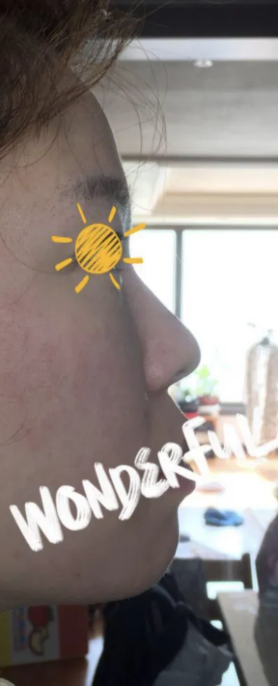 [코] Shee288 - 콧대,코끝