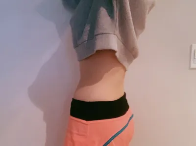 [지방흡입] yedu87 - 다리,복부 지흡