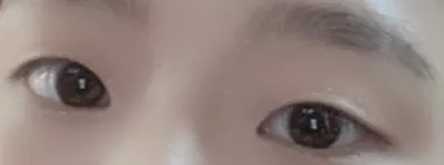 [눈] 이soo - 매몰,앞트임