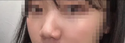 [코] 좌니왜전화안받니 - 코