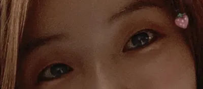 [눈] 하바바하 - 눈매교정,절개