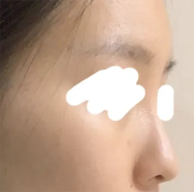 [코] 루삥뽕삥ㅇ - 코