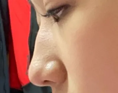 [코] 둥중이 - 코(실리콘)