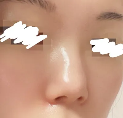 [코] 욤이쓰 - 코