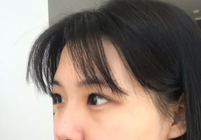 [눈] 응앙응 - 쌍꺼풀(자연유착), 윗트임