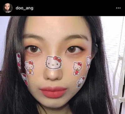 [눈] 솜하나 - 쌍꺼풀, 윗트임